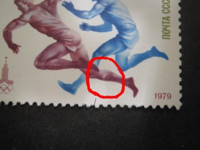 &amp;quot; Травма &amp;quot; голени.